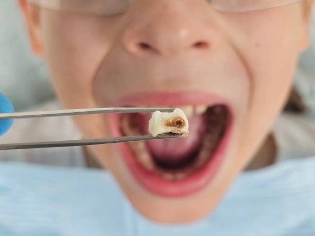 Best Emergency Dental Surgery in Hudson Lake, IN